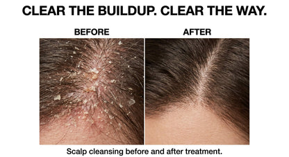 Tea Tree & Mint Scalp Exfoliating Scrub
